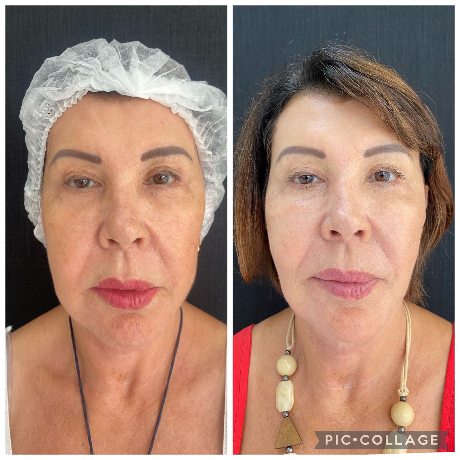 WhatsApp Image 2024-01-23 at 10.40.04