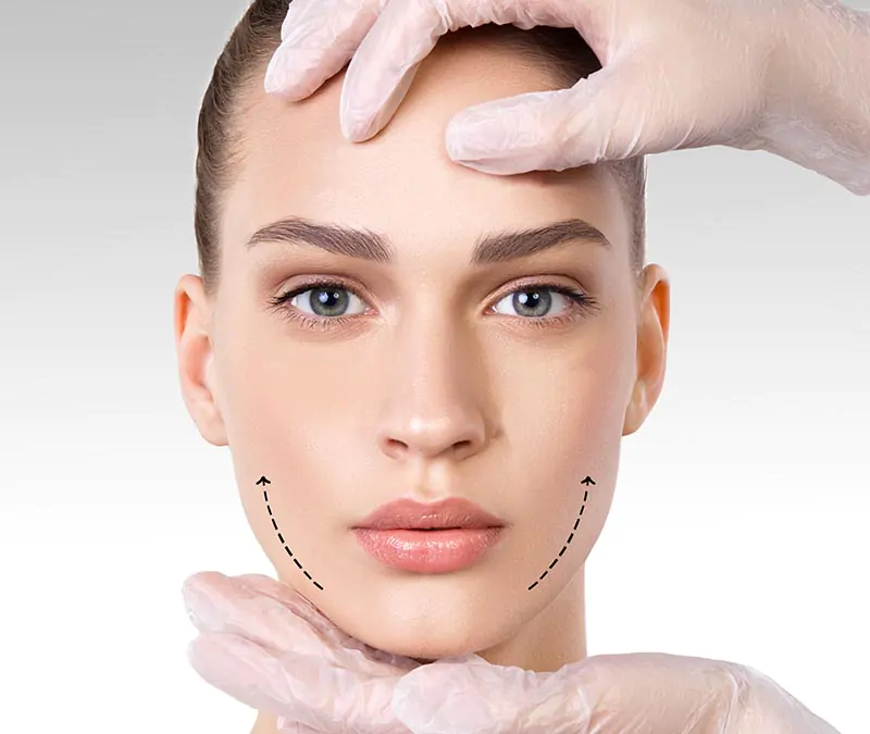 bichectomia-linhas-faciais dra daniela leal